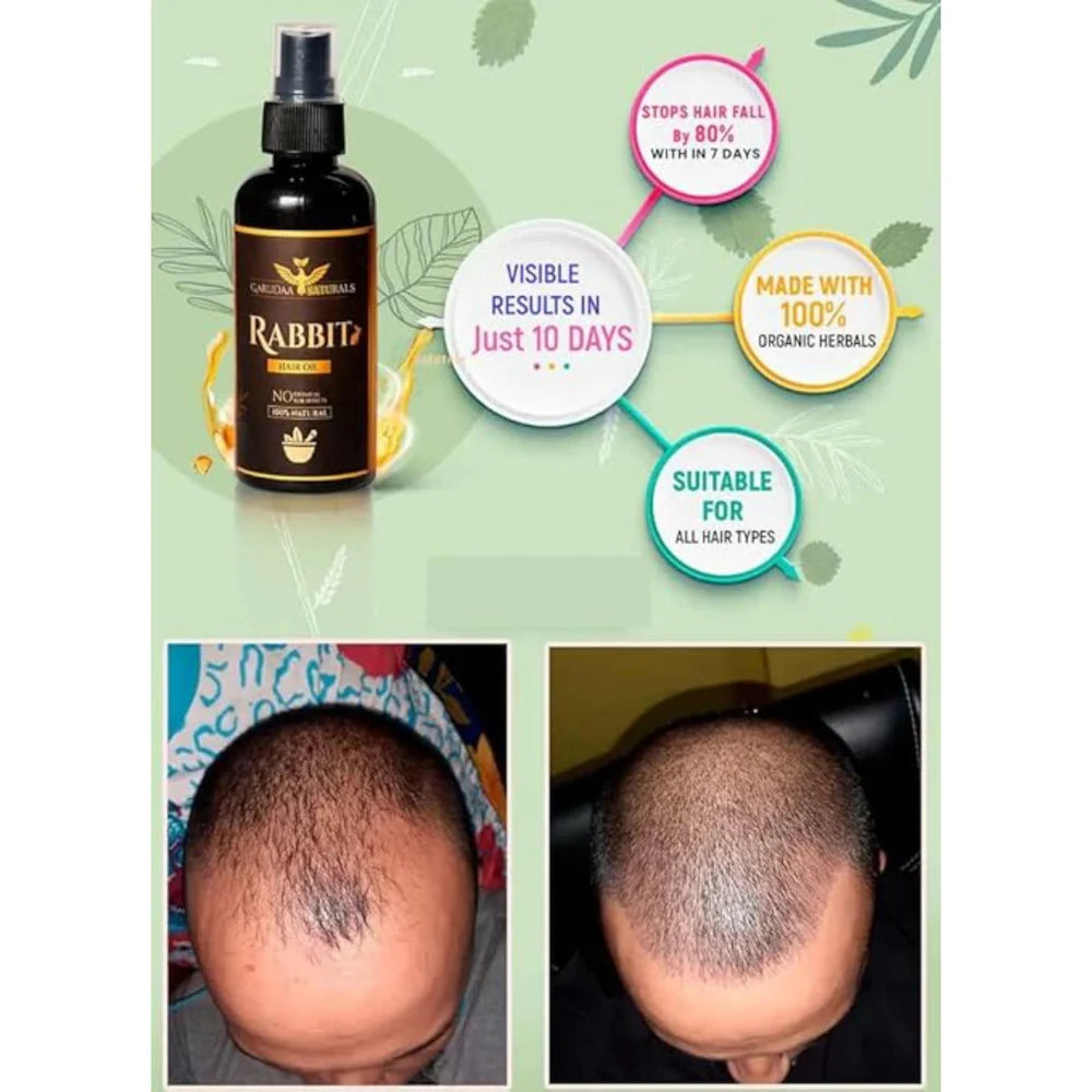Rabbit blood hair growth oil 100%